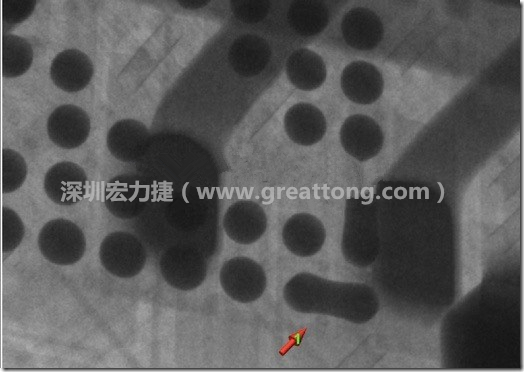BGA因?yàn)楹笁|變小，造成錫膏過多而最終形成焊接短路的結(jié)果。
